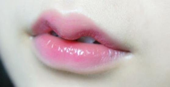 花瓣唇和仰月唇区别